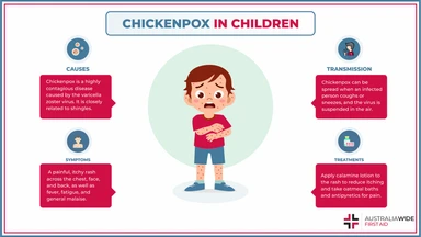 Infographic on Chickenpox in Children